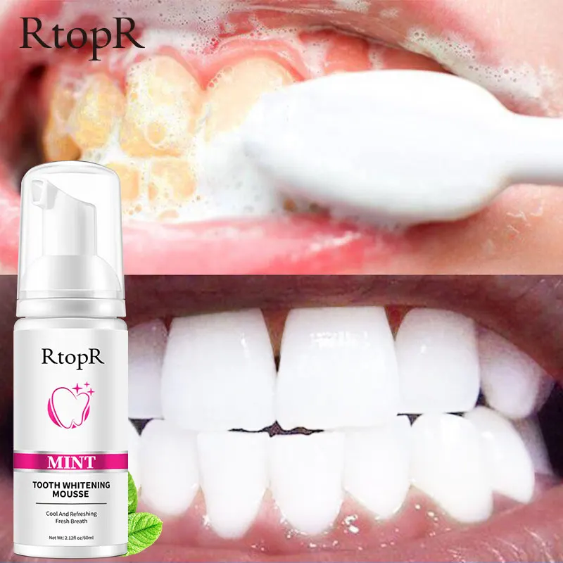 RtopR Mint Tooth Whitenging Mousse Oral Cleaning Whitening Teeth Plaque Stains Removal Remove Odor Oral Refreshing Whiten Teeth